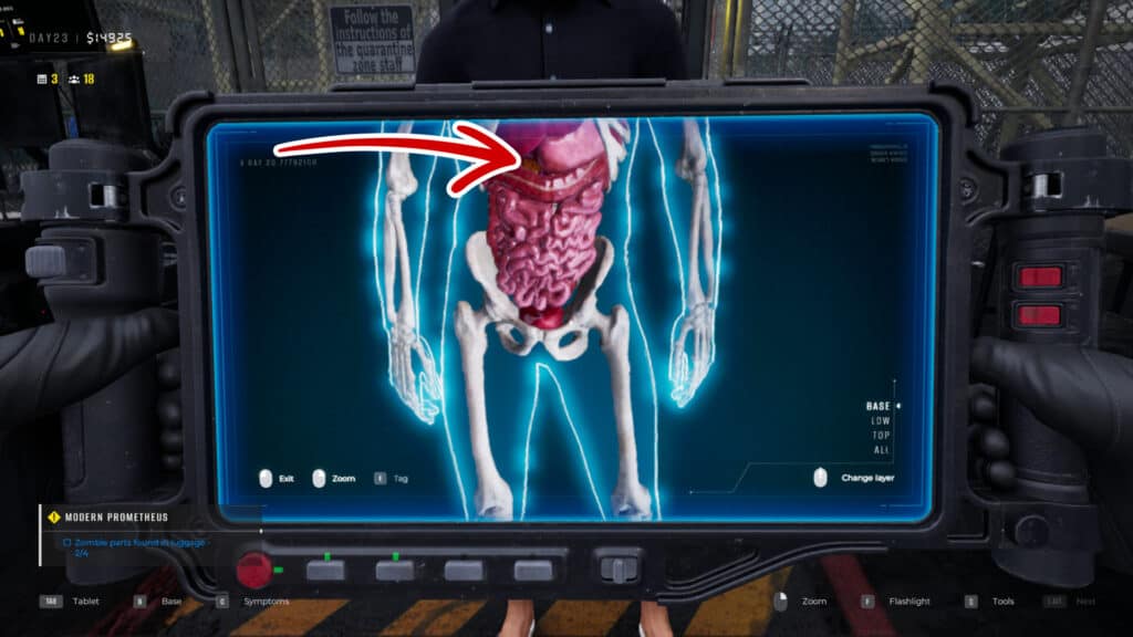 Síntomas en Quarantine Zone