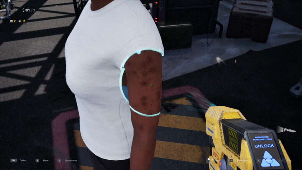 Síntomas en Quarantine Zone